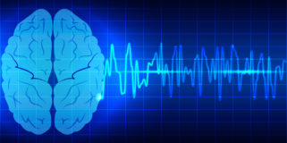 The biggest cognitive biases for traders and why we think they matter